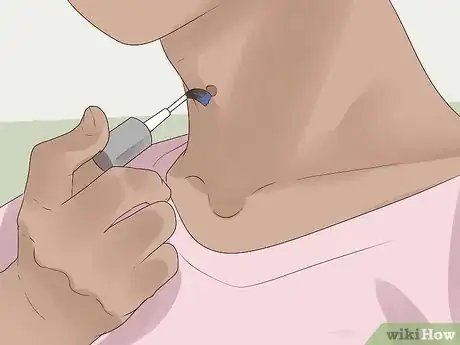 Immagine titolata Get Rid of Skin Tags Step 18