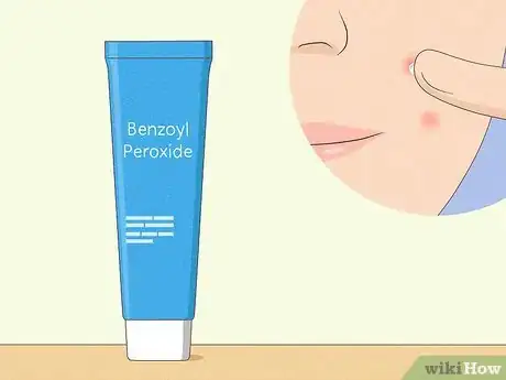 Immagine titolata Reduce the Swelling and Redness of Pimples Step 9