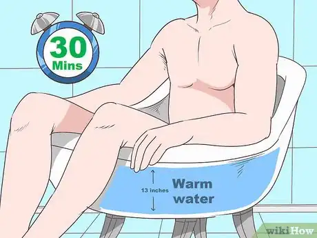 Immagine titolata Know if You Have Epididymitis Step 20