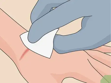 Immagine titolata Treat a Puncture Wound Step 14