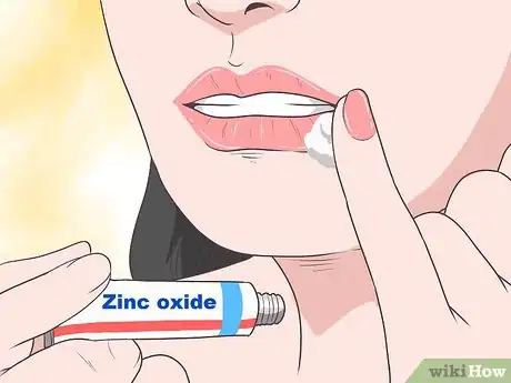 Immagine titolata Treat a Cold Sore or Fever Blisters Step 7