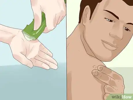 Immagine titolata Get Rid of Skin Tags Step 10