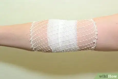 Immagine titolata Strap an Elbow Step 12