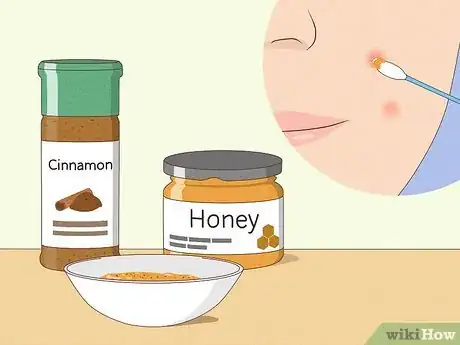 Immagine titolata Reduce the Swelling and Redness of Pimples Step 7