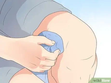 Immagine titolata Get Rid of a Cut Step 5