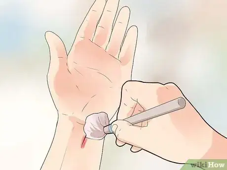 Immagine titolata Get Rid of a Cut Step 4