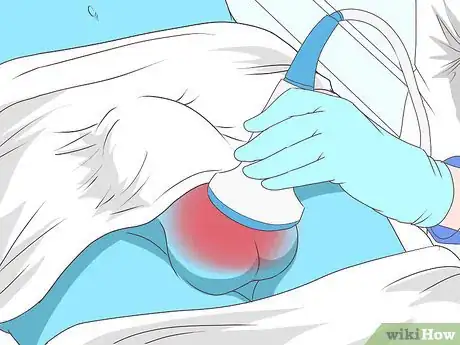 Immagine titolata Know if You Have Epididymitis Step 15