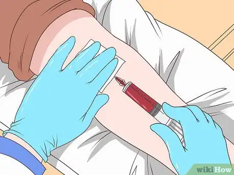 Immagine titolata Know if You Have Epididymitis Step 14
