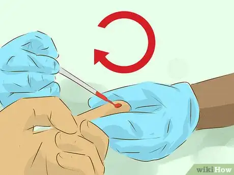 Immagine titolata Get Tested for HIV Step 9