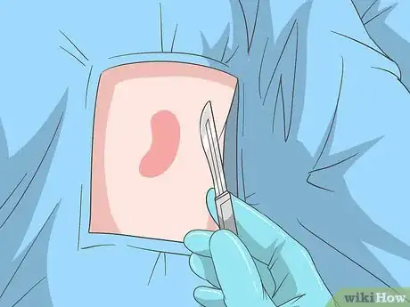 Immagine titolata Raise Blood Platelet Level Naturally Step 4