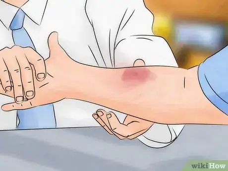 Immagine titolata Pick up a Tarantula Step 9