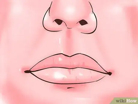Immagine titolata Diagnose an Overbite Step 1