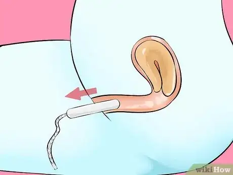 Immagine titolata Remove a Tampon Step 1