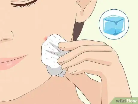 Immagine titolata Reduce the Swelling and Redness of Pimples Step 1