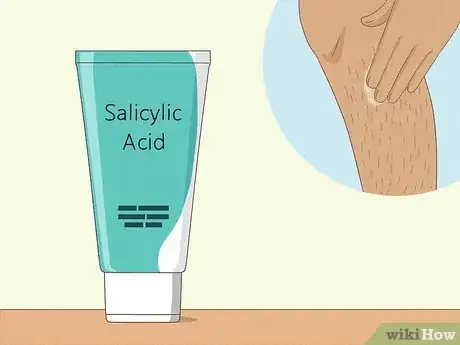 Immagine titolata Prevent Ingrown Hairs After Waxing Using Home Remedies Step 4