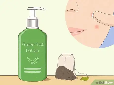 Immagine titolata Reduce the Swelling and Redness of Pimples Step 4