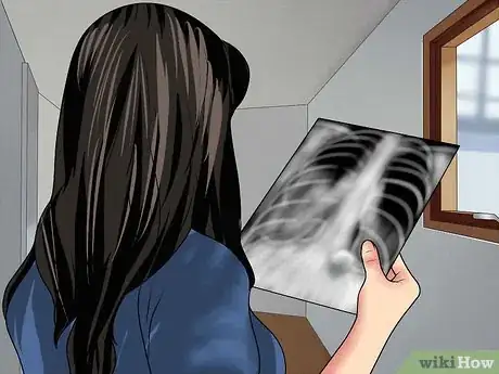 Immagine titolata Read a Chest X Ray Step 12