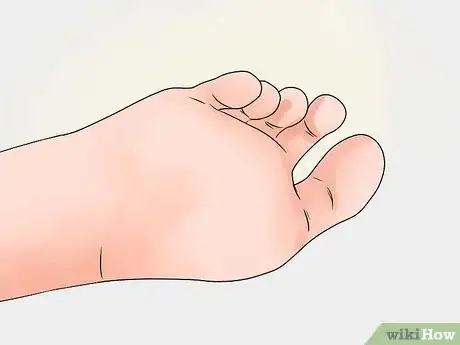Immagine titolata Care for a Burst Blister Step 11