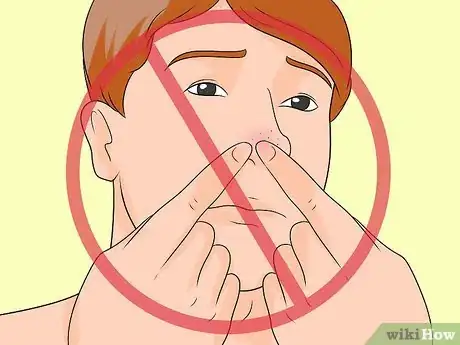Immagine titolata Prevent Blackheads Step 9