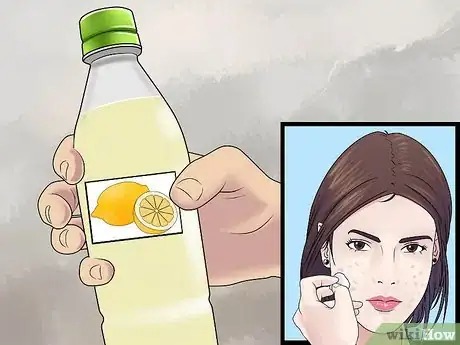 Immagine titolata Get Rid of Cystic Acne Scars Step 2