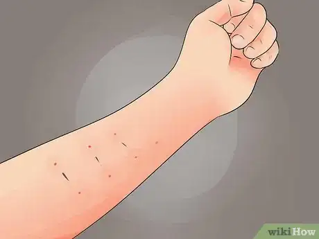 Immagine titolata Tell if a Tattoo Is Infected Step 9