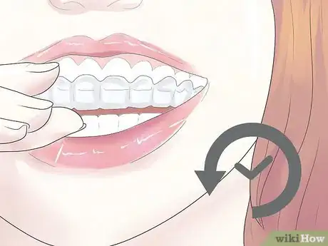 Immagine titolata Cope with Teeth Whitening Sensitivity Step 7