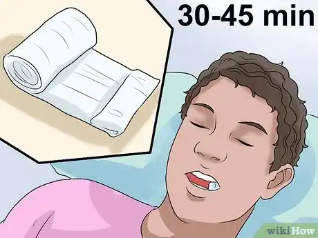 Immagine titolata Clean Your Teeth After Wisdom Teeth Removal Step 1