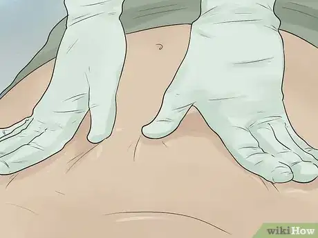 Immagine titolata Embalm Step 5