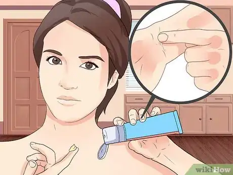 Immagine titolata Get Rid of a Cut Step 13
