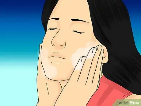 Immagine titolata Painlessly Pop a Pimple Step 3
