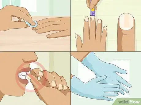 Immagine titolata Stop Itchy Cuticles Step 7