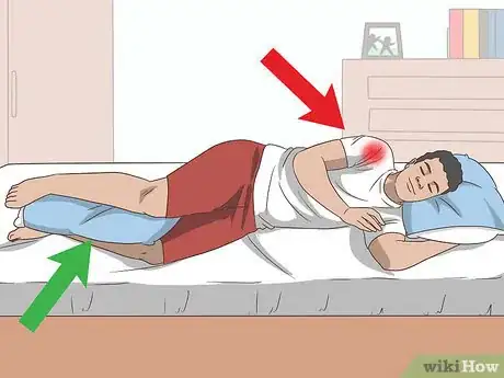 Immagine titolata Sleep with Rotator Cuff Pain Step 2