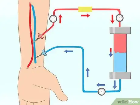 Immagine titolata Bring Down High Creatinine Levels Step 20