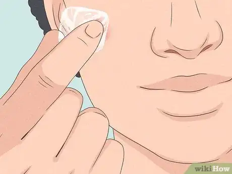 Immagine titolata Get Rid of a Zit Overnight Step 8