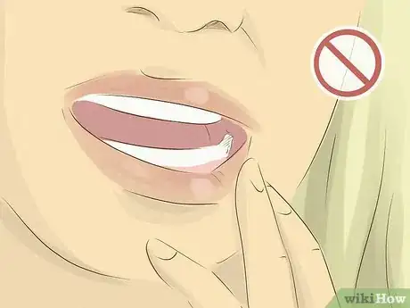 Immagine titolata Recover after Wisdom Teeth Surgery Step 2