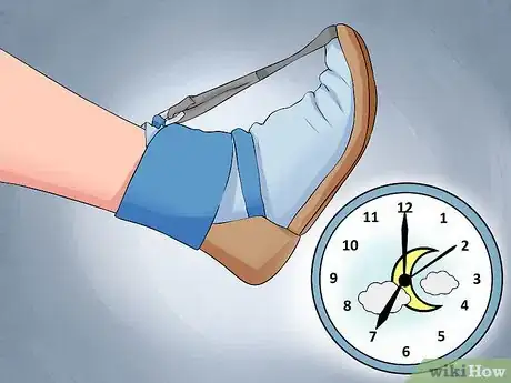 Immagine titolata Treat Plantar Fasciitis Step 5