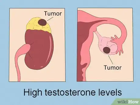 Immagine titolata Lower Testosterone Levels Step 8