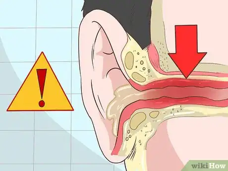 Immagine titolata Get Rid of Ear Wax Step 1