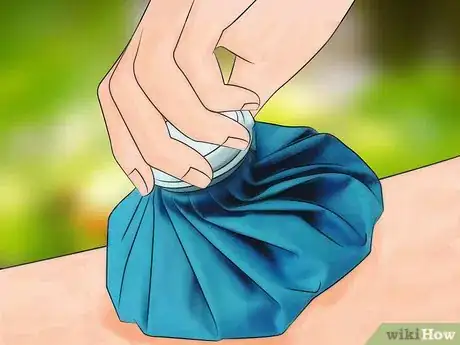 Immagine titolata Identify Insect Bites Step 11