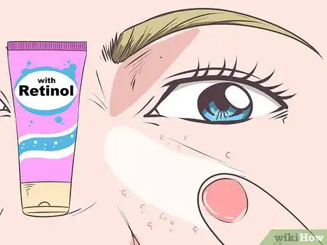 Immagine titolata Get Rid of Milia Step 3