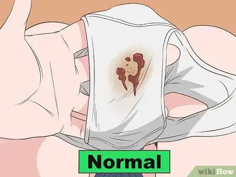 Immagine titolata Tell if Vaginal Discharge Is Normal Step 5