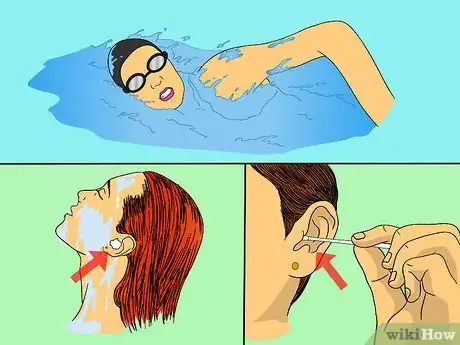Immagine titolata Get Rid of Swimmer's Ear Step 2