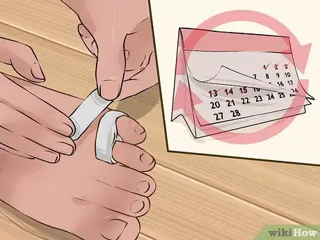 Immagine titolata Tape a Broken Pinky Toe Step 5