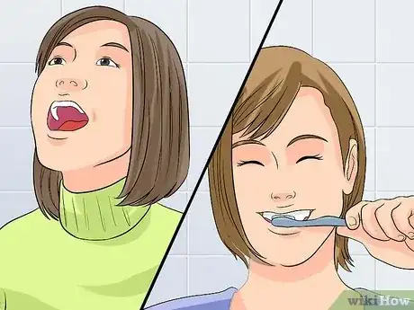 Immagine titolata Clean Your Teeth After Wisdom Teeth Removal Step 5