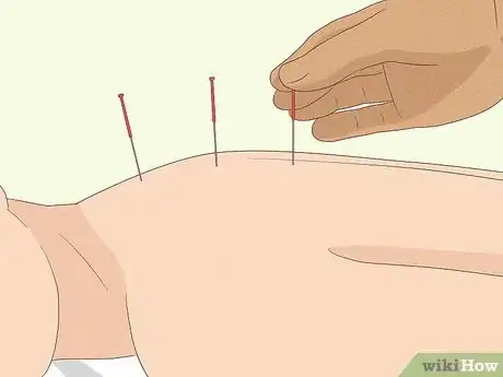 Immagine titolata Get Rid of Gallstones Step 9