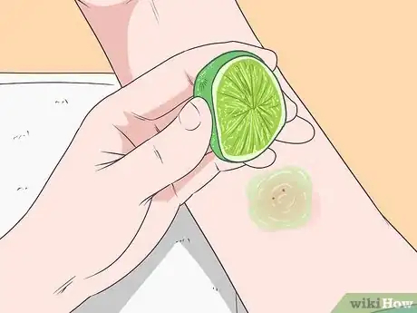 Immagine titolata Stop Mosquito Bites from Itching Step 1