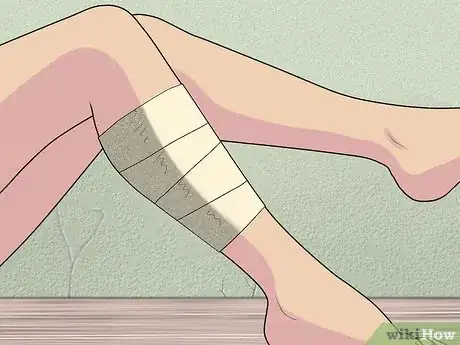 Immagine titolata Treat a Pulled Muscle Step 3