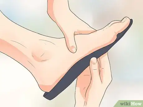 Immagine titolata Get Rid of Shin Splints Fast Step 11