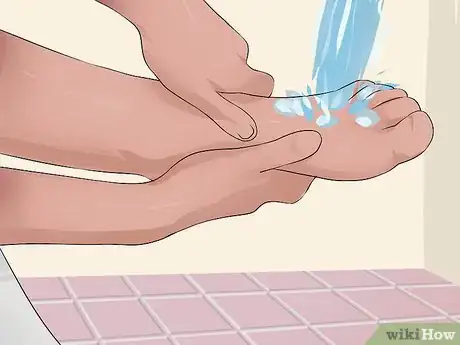 Immagine titolata Tape a Broken Pinky Toe Step 2