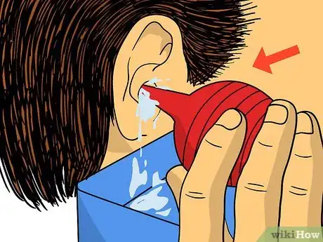 Immagine titolata Get Rid of Swimmer's Ear Step 7